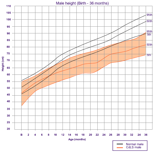 Cornelia De Lange Syndrome Growth Chart