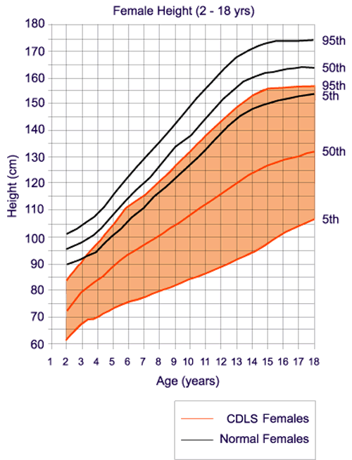 Cornelia De Lange Syndrome Growth Chart