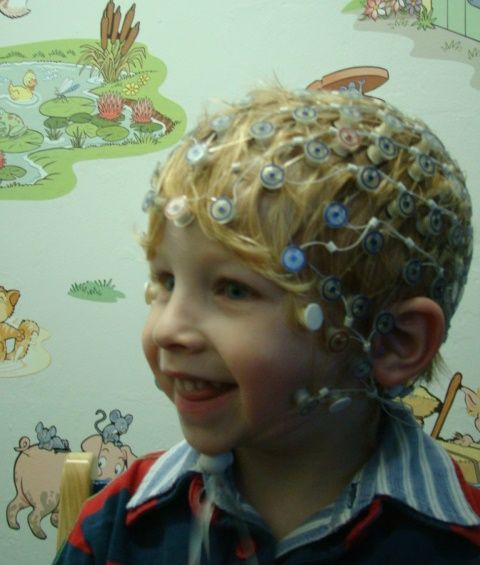 EEG Cap